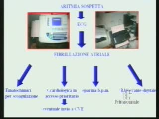 DICA 33 -  CHE COS'E' LA TELECARDIOLOGIA