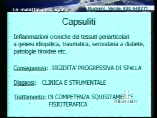 DICA 33 - CHE COS'E' LA CAPSULITE?