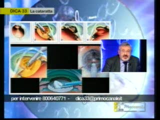 DICA 33 - CATARATTA, COSA SONO I CRISTALLINI ARTIFICIALI?