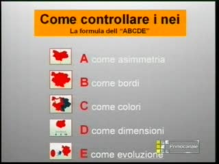 DICA 33 - COME CONTROLLARE I NEI