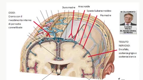 Meningite e sepsi da meningococco, quali sono le differenze?